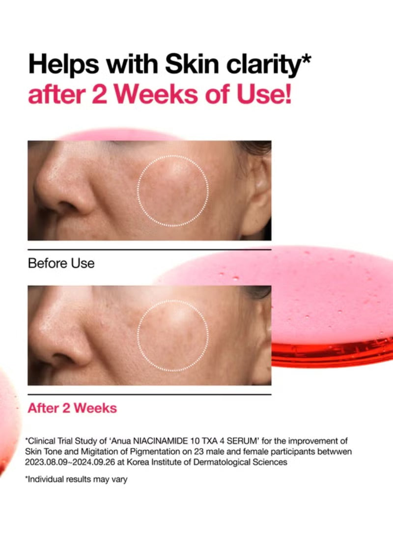 Niacinamide 10% + Txa 4% Serum 30Ml Packaging May Vary 30 mlml