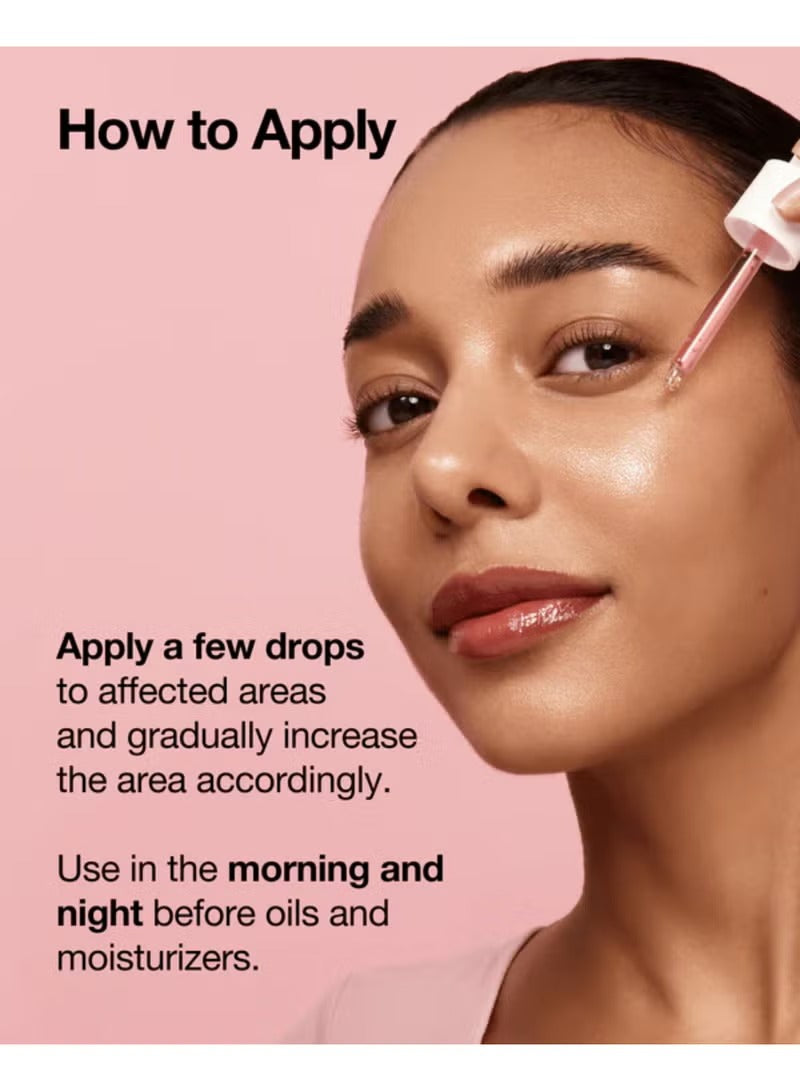 Niacinamide 10% + Txa 4% Serum 30Ml Packaging May Vary 30 mlml